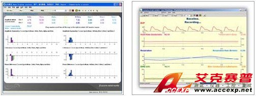  多參數生物反饋儀